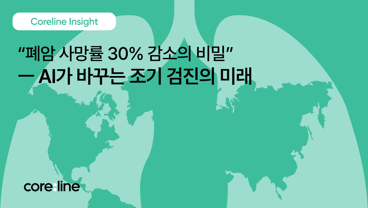폐암 사망률 30% 감소의 비밀 - AI가 바꾸는 조기 검진의 미래